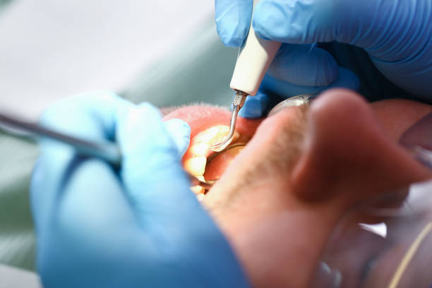 Best Broken or Chipped Tooth Repair in Robbins, IL